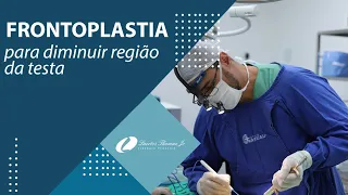 FRONTOPLASTIA | CIRURGIA PLÁSTICA NA REGIÃO DA TESTA E SOBRANCELHA | DR LAERTES THOMAZ JR