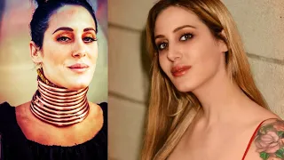 This Woman Finally Takes Off Her Neck Rings After 5 Long Years Of Trying To Resemble A Giraffe