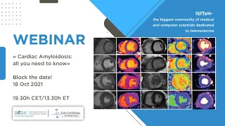 Webinar « Cardiac Amyloidosis: All you need to know »