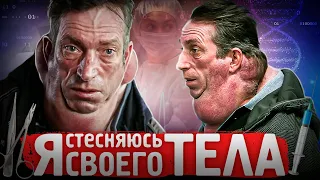 ОПУХОЛИ РАСТУТ ПО ВСЕМУ ТЕЛУ! Я СТЕСНЯЮСЬ СВОЕГО ТЕЛА