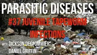 Parasitic Diseases Lectures #37: Juvenile Tapeworm Infections