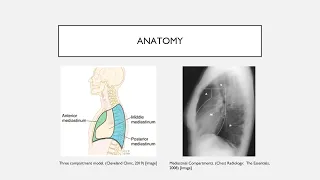 Mediastinal Masses