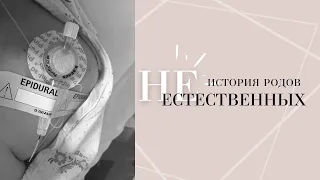 Стимуляция за день до ПДР. История родов Дарьи