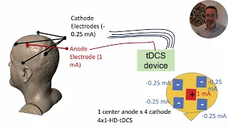 History (and basics) of High-Definition tDCS (HD-tDCS)