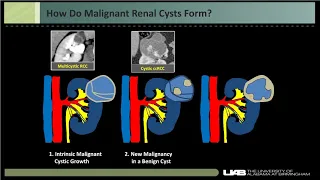 Imaging renal cystic masses