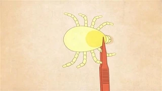 Tick Season: The Best Way to Remove a Tick