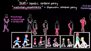 Types of cerebral palsy part 2 - Dyskinetic and ataxic | Mental health | NCLEX-RN | Khan Academy