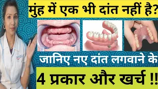 एक भी दांत ना हो तो नए दांत लगाने के 4 प्रकार और खर्च |Naye Dant Lagane Ka Kharcha |बत्तीसी का खर्चा