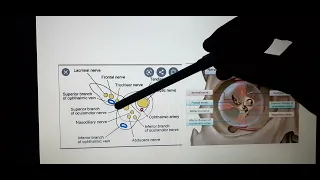 Structures passing through superior  orbital fissure(Imp for viva)