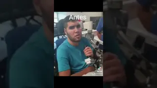 Prichard colon 🙏🏻😞 en recuperación