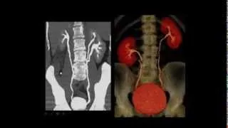 Anatomy revision part 1 by Dr. Amr Saadawy