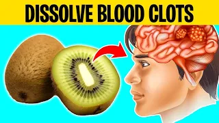 10 Foods That DISSOLVE Blood Clots Naturally