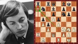 Anatoly Karpov Amazing Immortal Chess game vs Unzicker - Ruy Lopez - Nice Olympiad 1974