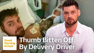 Delivery Attack: Driver Pleads Guilty After Biting Off Customers Thumb
