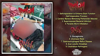 Trachoma / Pancreatite Necro Hemorragica - Split CD FULL ALBUM (2020 - Goregrind)