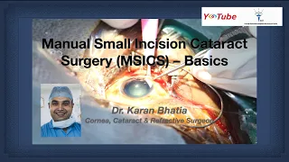 Manual Small Incision Cataract Surgery (MSICS) - Basics - Dr. Karan Bhatia