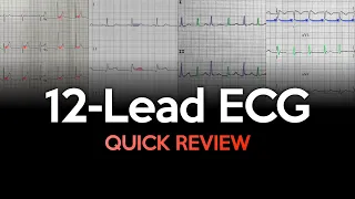 Quick Review of ECGs