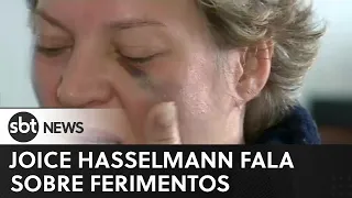 Exclusivo: Joice Hasselmann fala sobre ferimentos que sofreu e mostra hematomas