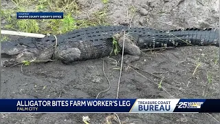 'A lot of pain': Farmer shares story of being bit by alligator in Palm City