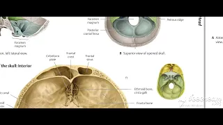 Middle cranial fossa 1