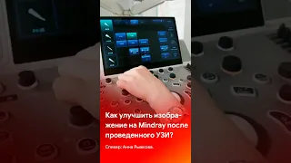 Как улучшить изображение на аппаратах Mindray после проведения #узи #mindray #shorts #short