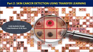 Part 2 | Skin Cancer Detection Using Transfer Learning Deep CNN Approach | Model Building