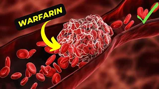 The Ultimate Guide to Understanding Warfarin, Its Benefits and side effects