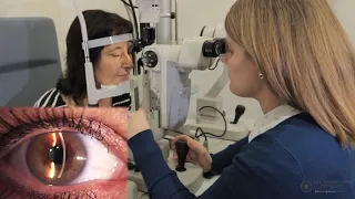 Slit Lamp Techniques   Van Herick's