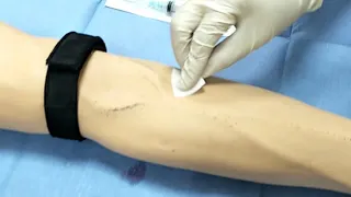 VENEPUNCTURE