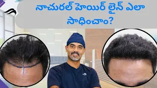 Hair Transplant In Hyderabad |Best Clinic Surgeon & Results Of Hair Transplant Surgery In Hyderabad