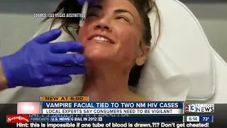 Vampire facial procedure explained after incident at New Mexico spa