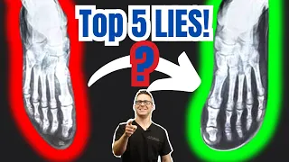 Top 5 Barefoot Shoes LIES! [Plantar Fasciitis, Bunions & Flat Feet]