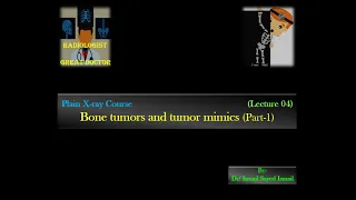 Radiographic Approach To -Bone tumors (For Radiology Residents)