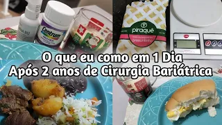 O que eu como em 1 dia após quase 2 anos de Cirurgia Bariátrica