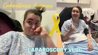 LAPAROSCOPY VLOG | Endometriosis diagnosis journey (NHS)