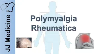 Polymyalgia Rheumatica | Signs & Symptoms, Diagnosis and Treatment