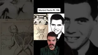 Morbid Facts about Dr. Josef Mengele #morbid #shorts