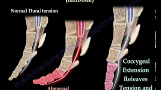 Coccyx, Tailbone pain /coccydynia - Everything You Need To Know - Dr. Nabil Ebraheim