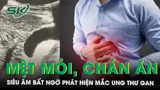 Mệt Mỏi, Chán Ăn, Siêu Âm Bất Ngờ Phát Hiện Mắc Ung Thư Gan | SKĐS