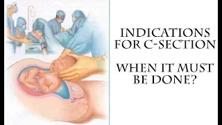 Reason for a C-section - When c-section must be done?