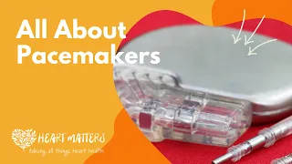 What you should know about pacemakers?