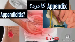 Appendicitis in urdu, hindi #appendicitis #appendectomy #appendix #pain