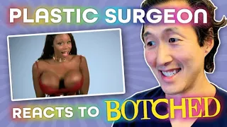 Her Areolas Are The Size of Pie PLATES?!?! Doctor Reacts to BOTCHED!