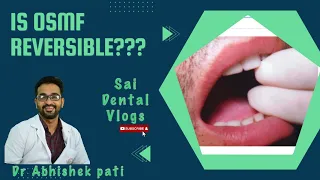 IS OSMF REVERSIBLE ? ( ORAL SUBMUCOUS FIBROSIS)