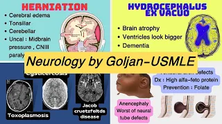 USMLE Neurology - by Goljan the best