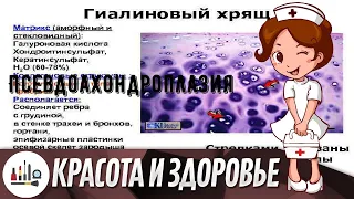 Псевдоахондроплазия