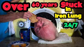 Paul Alexander, The last man living in the iron Lung