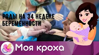 Роды на 34 неделе беременности