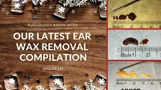 OUR LATEST EAR WAX REMOVAL COMPILATION - EP 119