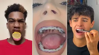 All Your TikTok Dental Pain In One Video!